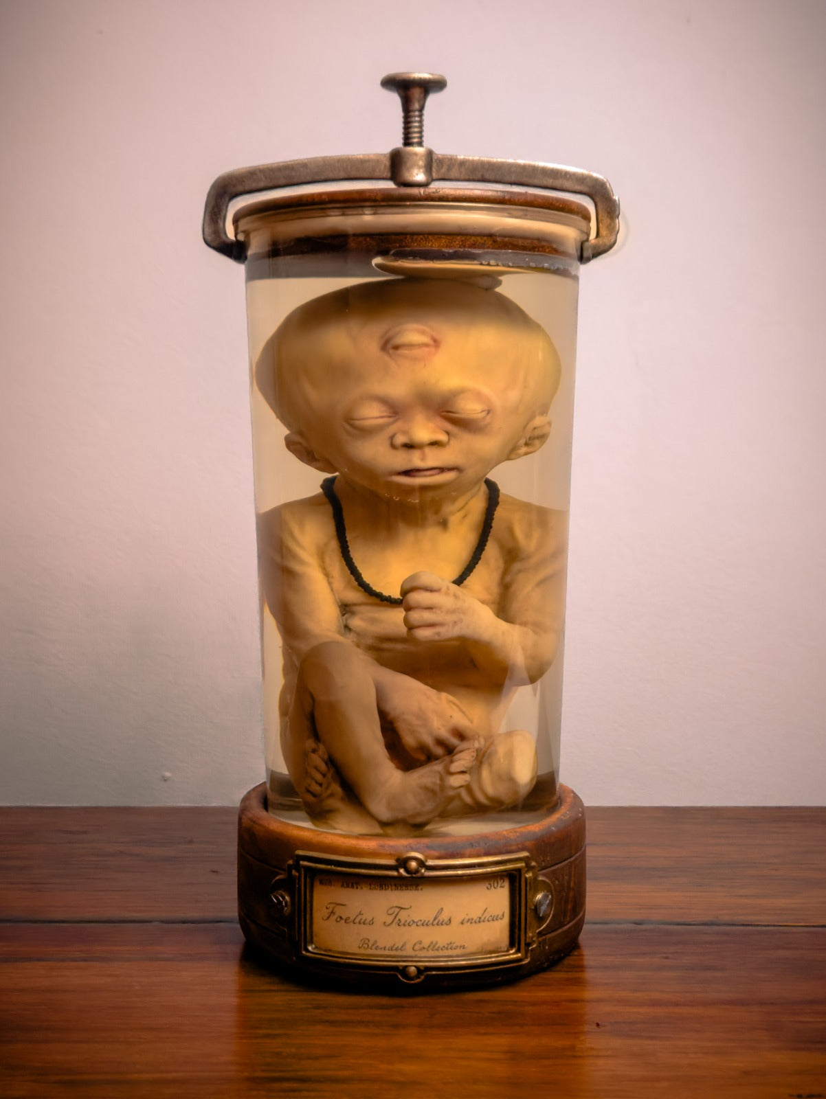 Trioculus Fetus, Three-Eyed Specimen Jar