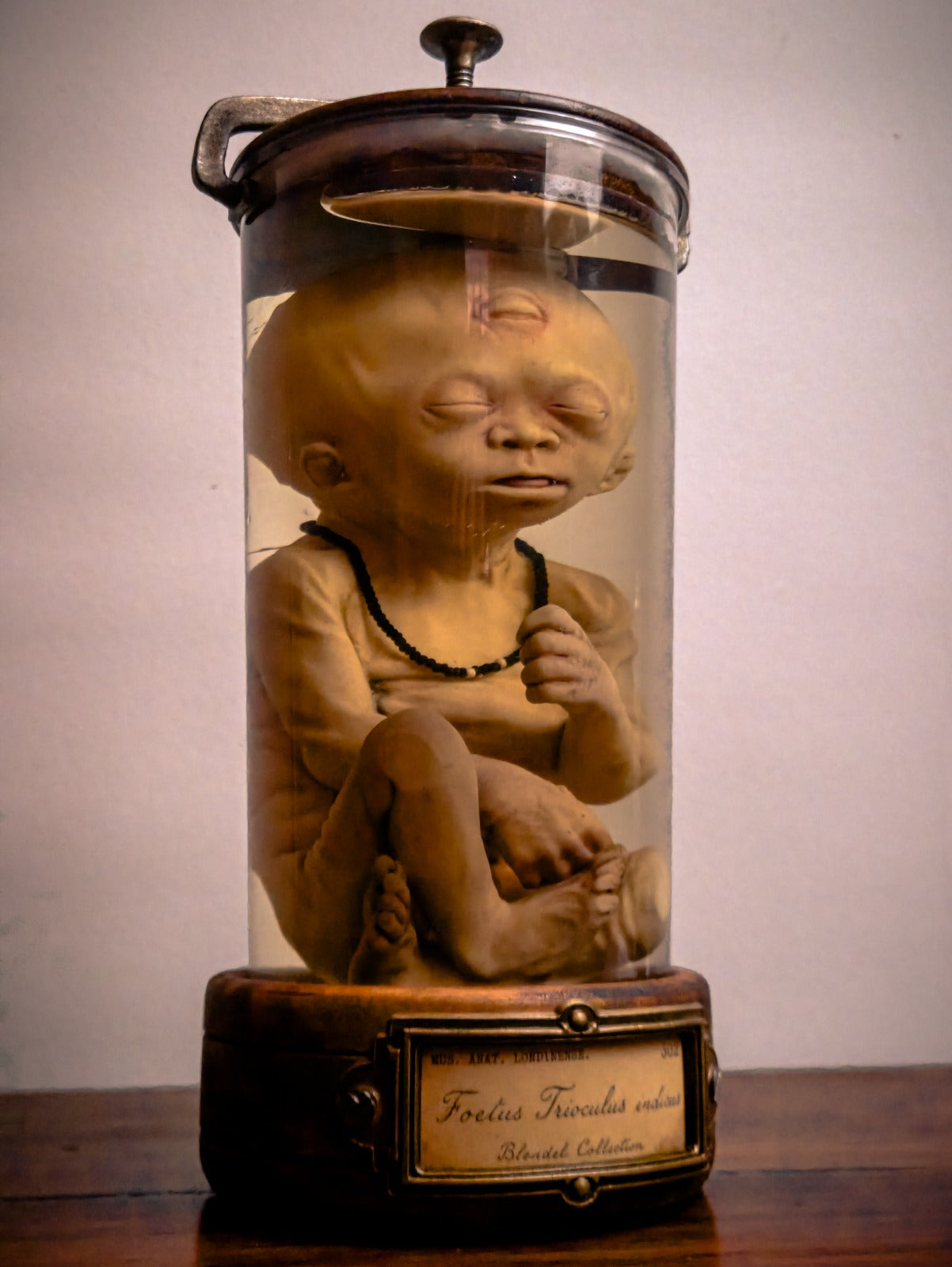 Trioculus Fetus, Three-Eyed Specimen Jar